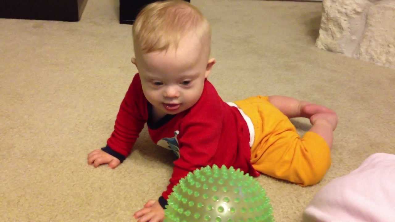 Baby with Down syndrome playing with parents and laughing