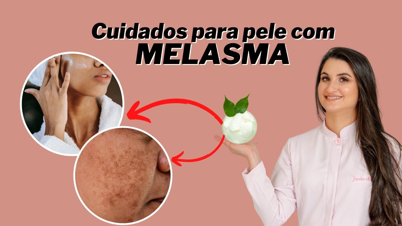 Cuidados para pele com Melasma - SkinCare