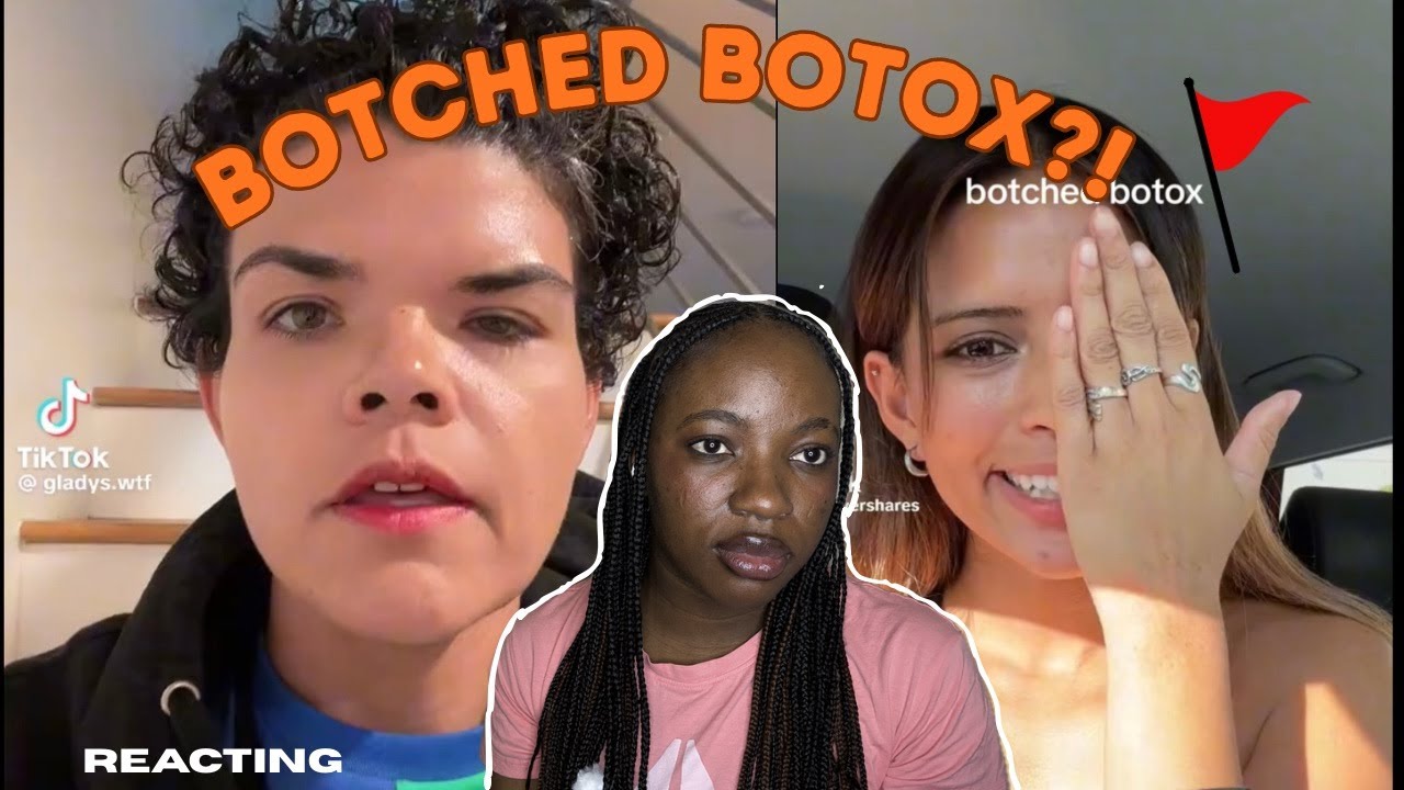 When Botox Goes Wrong 😳  Botched Botox Reaction