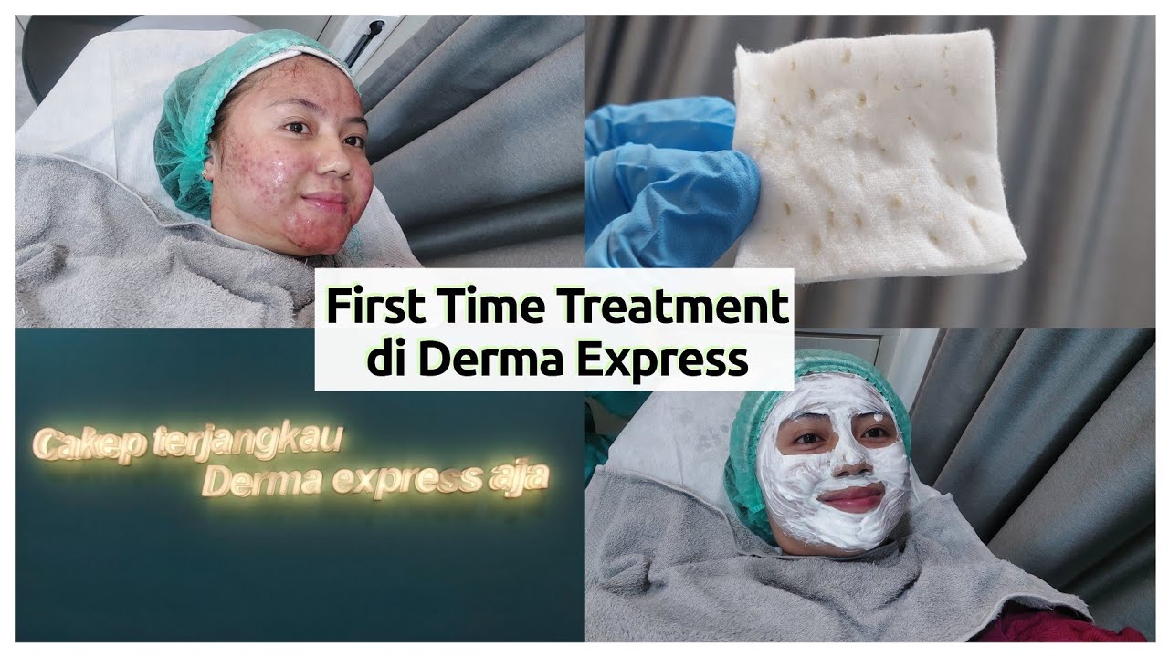 TREATMENT VLOG ✨ | Derma Express | Nuri Amaliyah