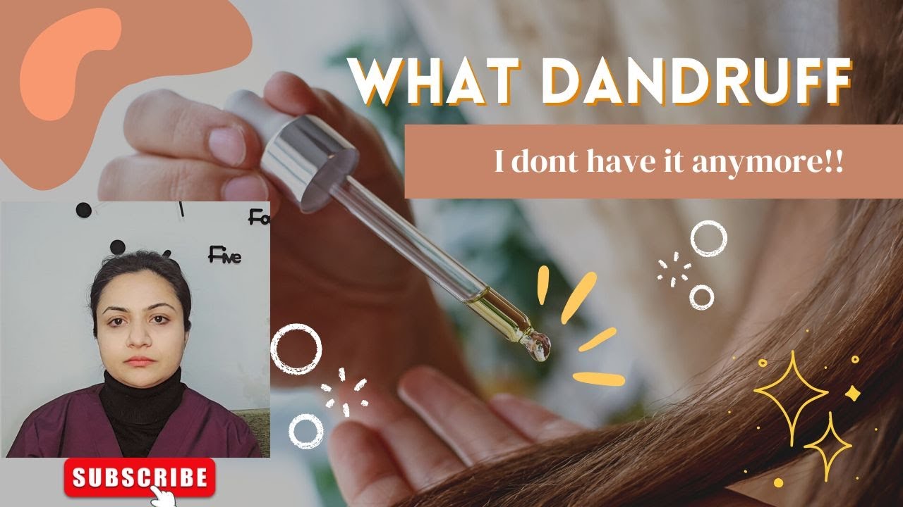 how to get rid of dandruff permanently