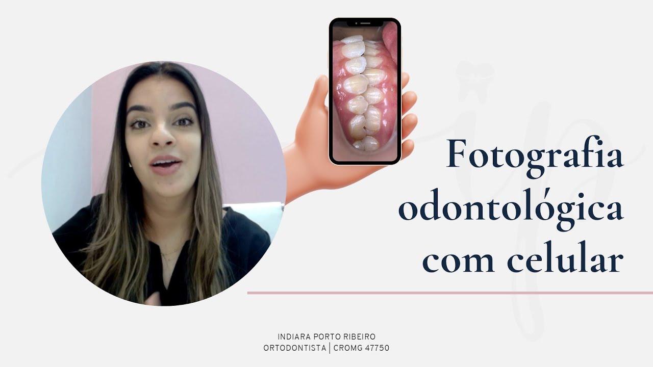 Fotografia odontológica com celular