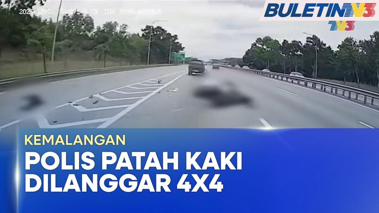 KEMALANGAN | Anggota Pengiring Patah Kaki Dilanggar Pikap
