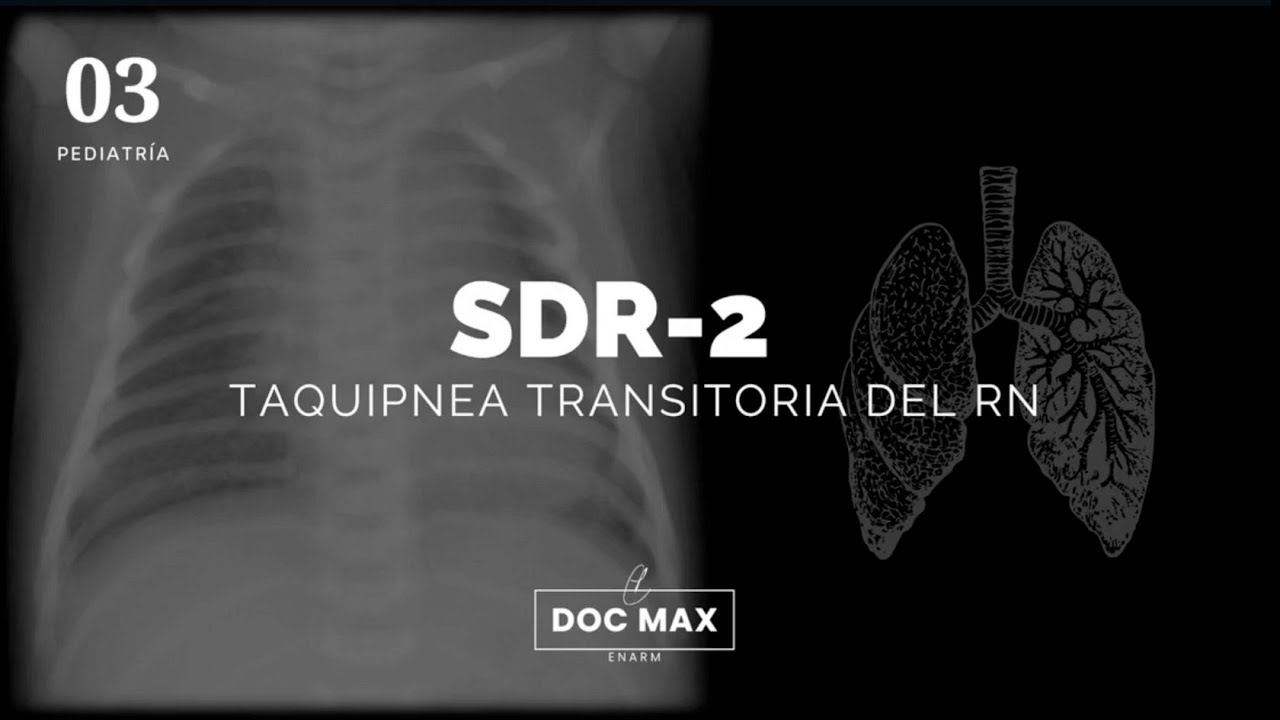 Taquipnea transitoria del recién nacido - ENARM