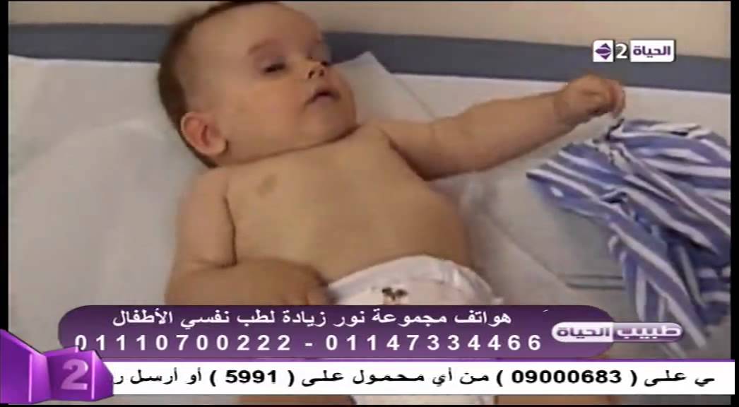 طبيب الحياة - فيديو توضيحي لأعراض مرض الصرع عند الأطفال - د. حاتم زاهر - إستشاري طب نفس الأطفال