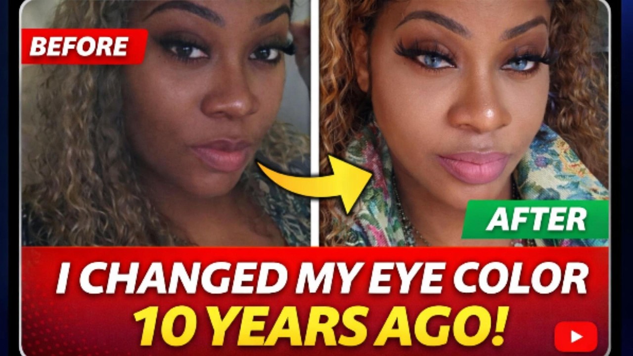 I Removed My Eye Color After 10 Years… Surgery Day Vlog 😳