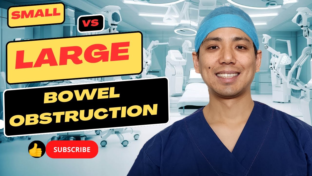 Small vs Large Bowel Obstructions. What's the difference?