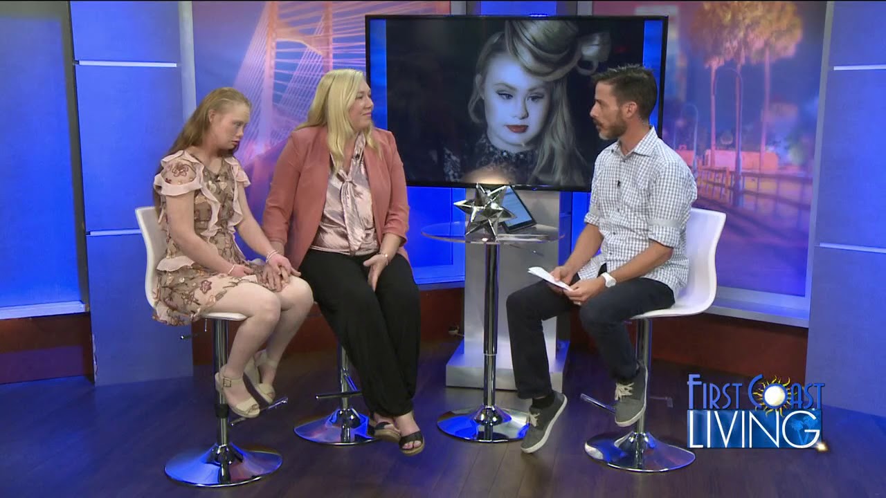 FCL Thursday November 2nd 2017 Model Madeline Stuart