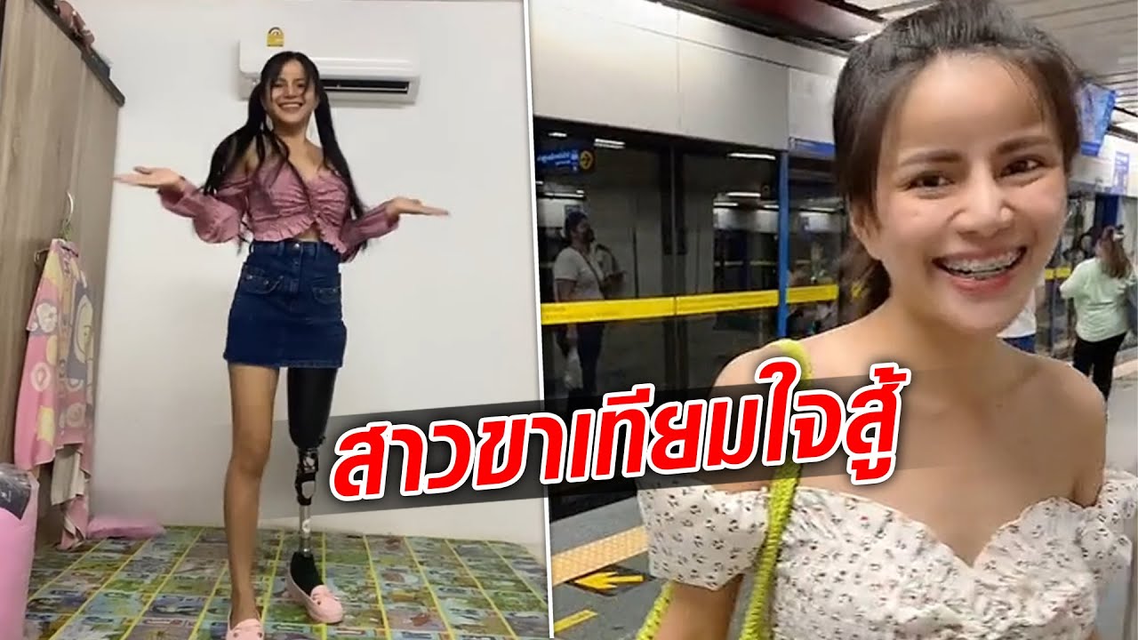 สาวเล่าชีวิตที่ถูกตัดขา กระทบจิตใจอย่างหนัก แต่ใจยังสู้ ใช้ชีวิตที่มีขาเทียม : Khaosod TV