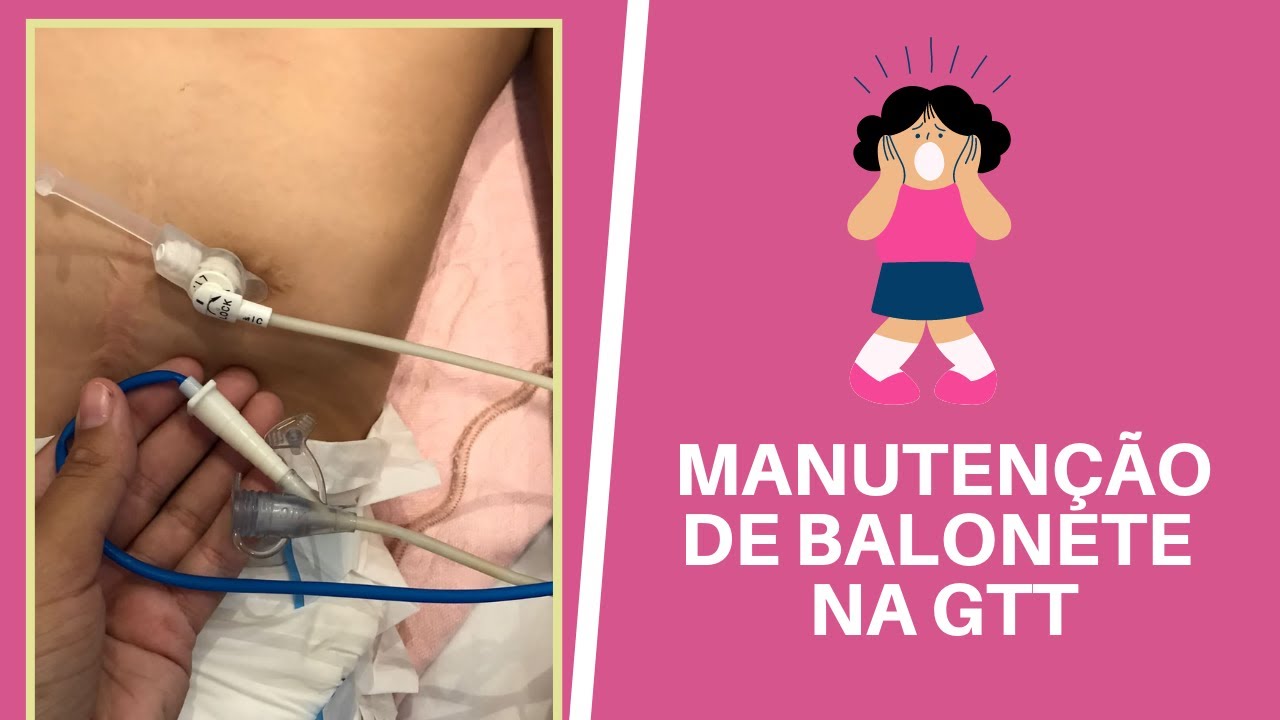 MANUTENÇÃO DE BALONETE NA GASTROSTOMIA