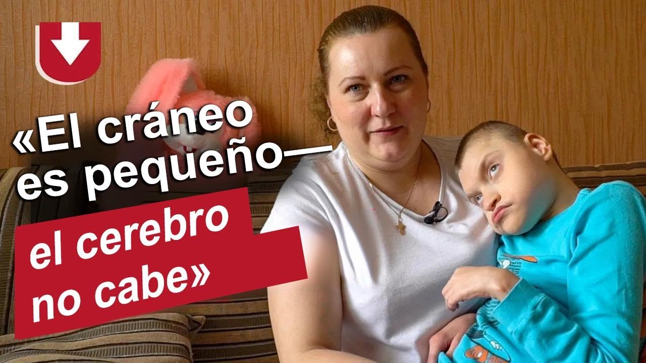 Mi hijo tiene microcefalia: la historia de Anya | Ser mamá