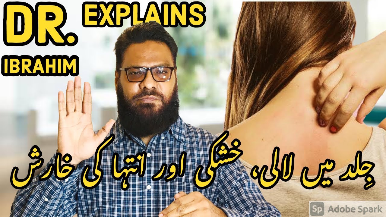 Skin Mein Lali, Kushki | Kharish Ka Ilaj | Treat Itchy & Red Skin | Dr. Ibrahim