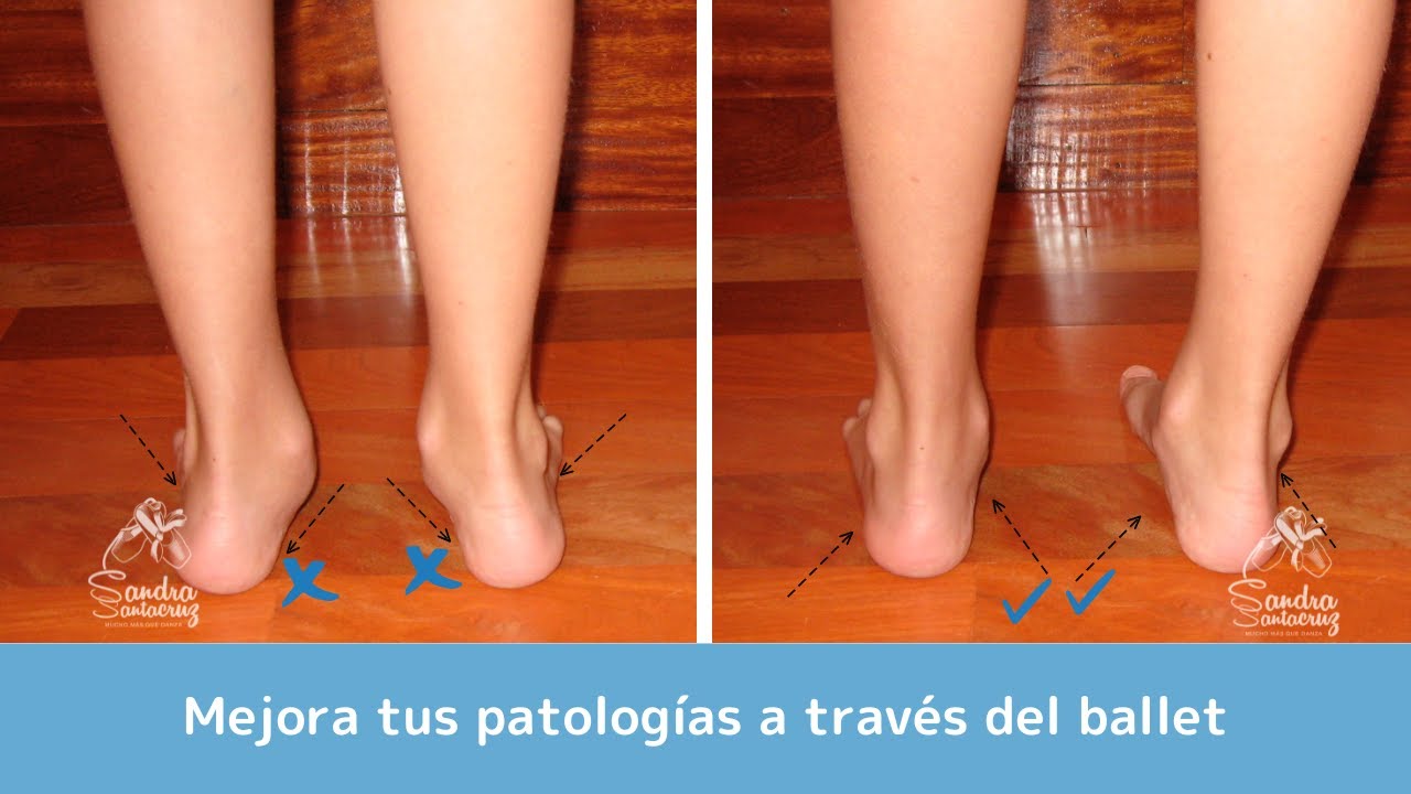 ¿Sabías que es posible bailar y mejorar tus patologías?