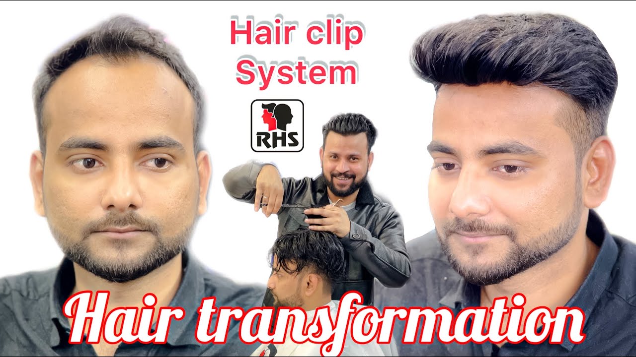 Clip On System | Hair Fixing With Clip System| Removable Hair System | Easy To Use Hair Patch System