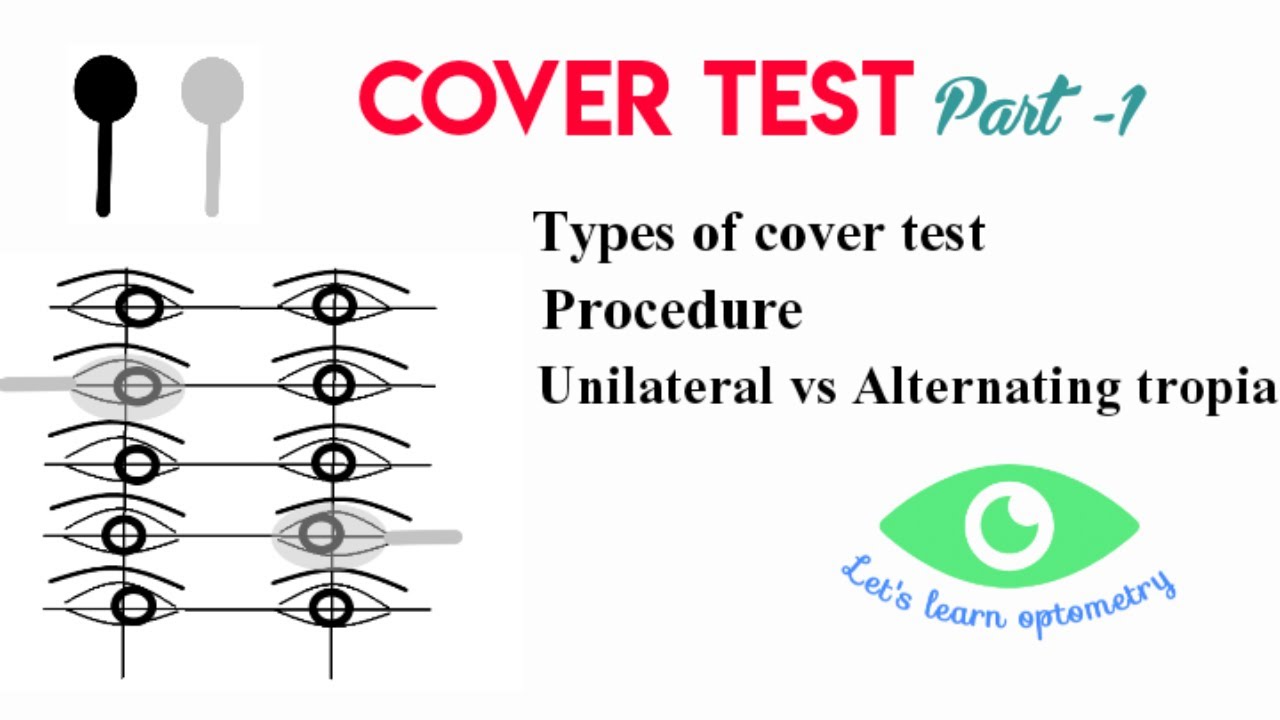 Cover test- Part 1 | Types of cover test | Cover | uncover| Alternate cover