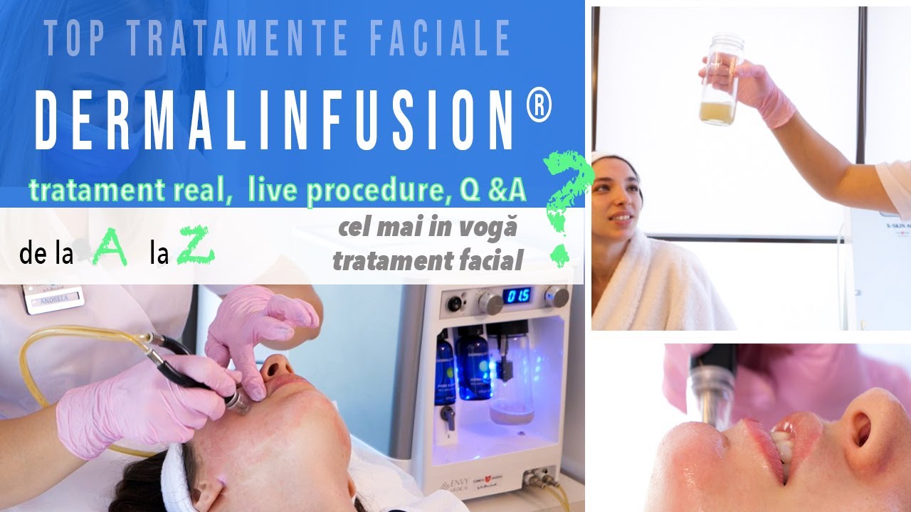 De ce să-ti faci măcar o dată DERMALINFUSION®? // Tratament real LIVE, Before & After