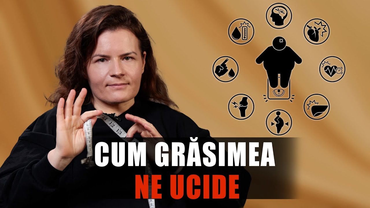 Grăsimea ne ucide | Am varice din cauza obezității