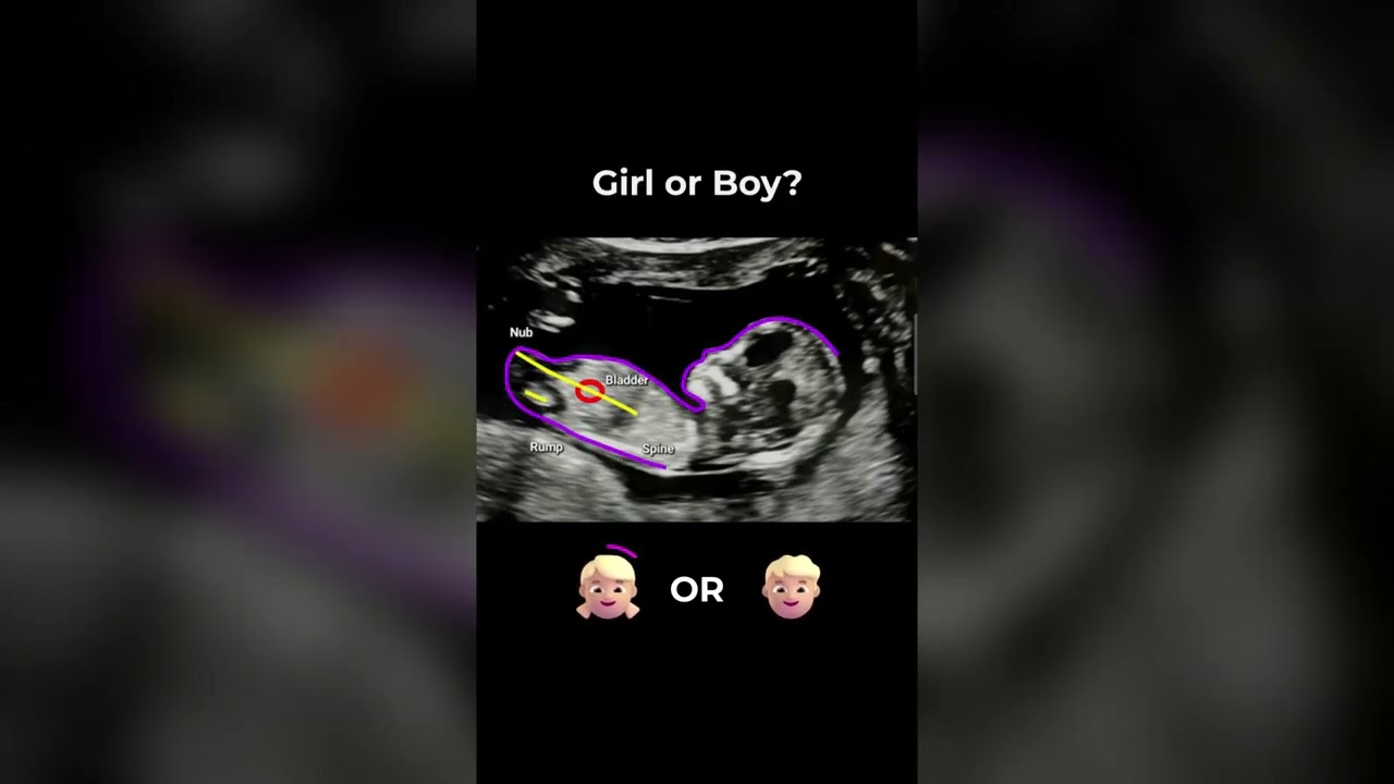 AI Gender Reveal app in the world, NubX #pregnancy  #babygender #genderexpression #pregnant