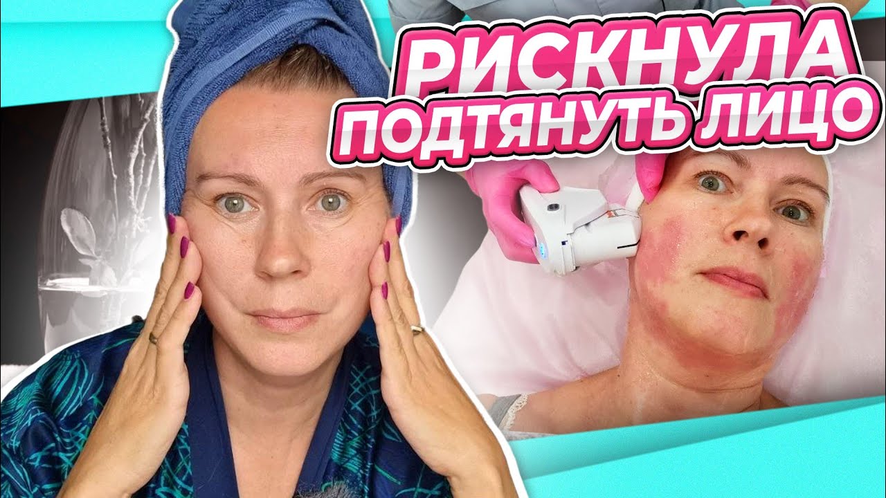РЕЗАТЬ НЕ ХОЧУ ПОДТЯЖКА | SMAS СМАС лифтинг ОПЫТ ЦЕНЫ АППАРАТЫ КОНСУЛЬТАЦИЯ