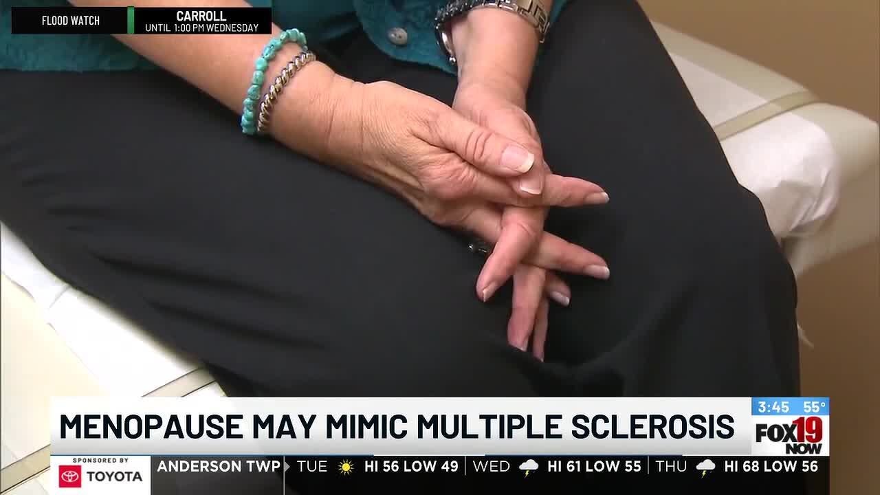 Menopause may mimic Multiple Sclerosis