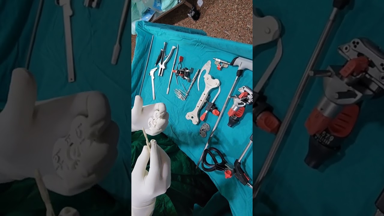 TOTAL KNEE REPLACEMENT DEPUY ATTUNE TKR TIBIA AND FEMUR CUTTING ASSEMBLY