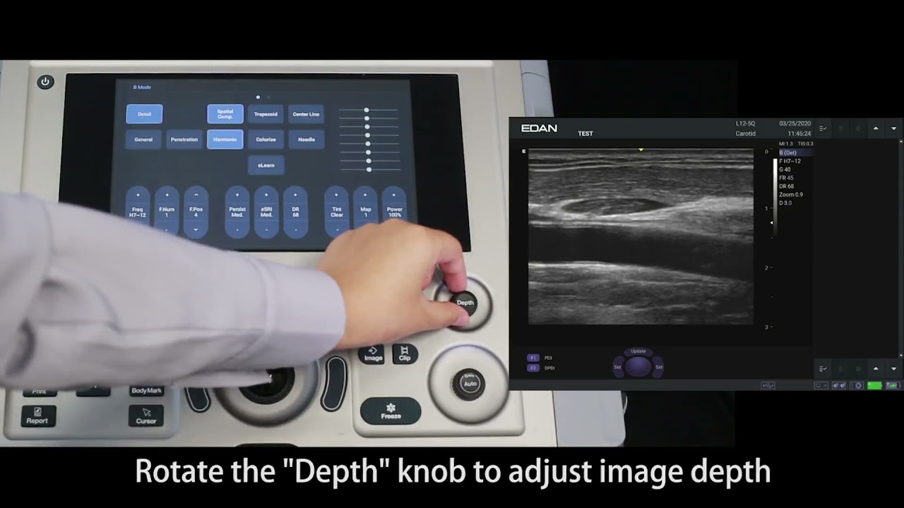 Edan AX3 Ultrasound Machine - User /Setup Operation Video