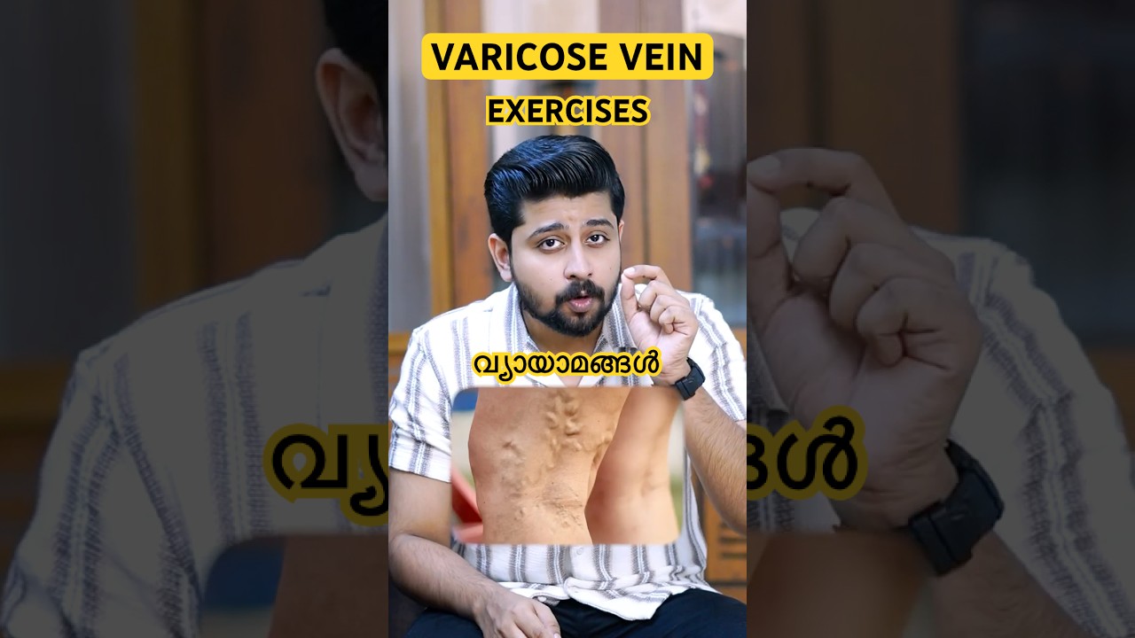 Varicose vein-പ്രധിരോധിക്കാനും നിയന്ത്രിക്കാനും സഹായിക്കുന്ന Exercises#youtubeshorts #shorts #short