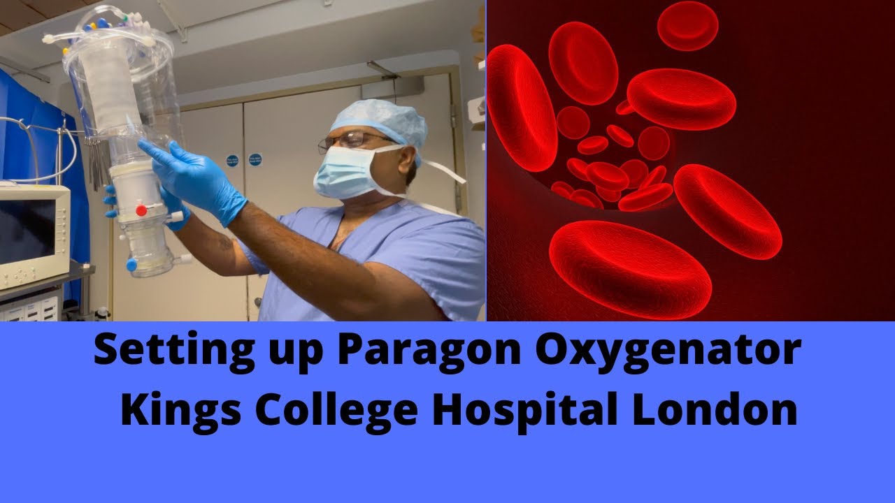 Setting up Paragon Oxygenator,   Kings College Hospital ,London