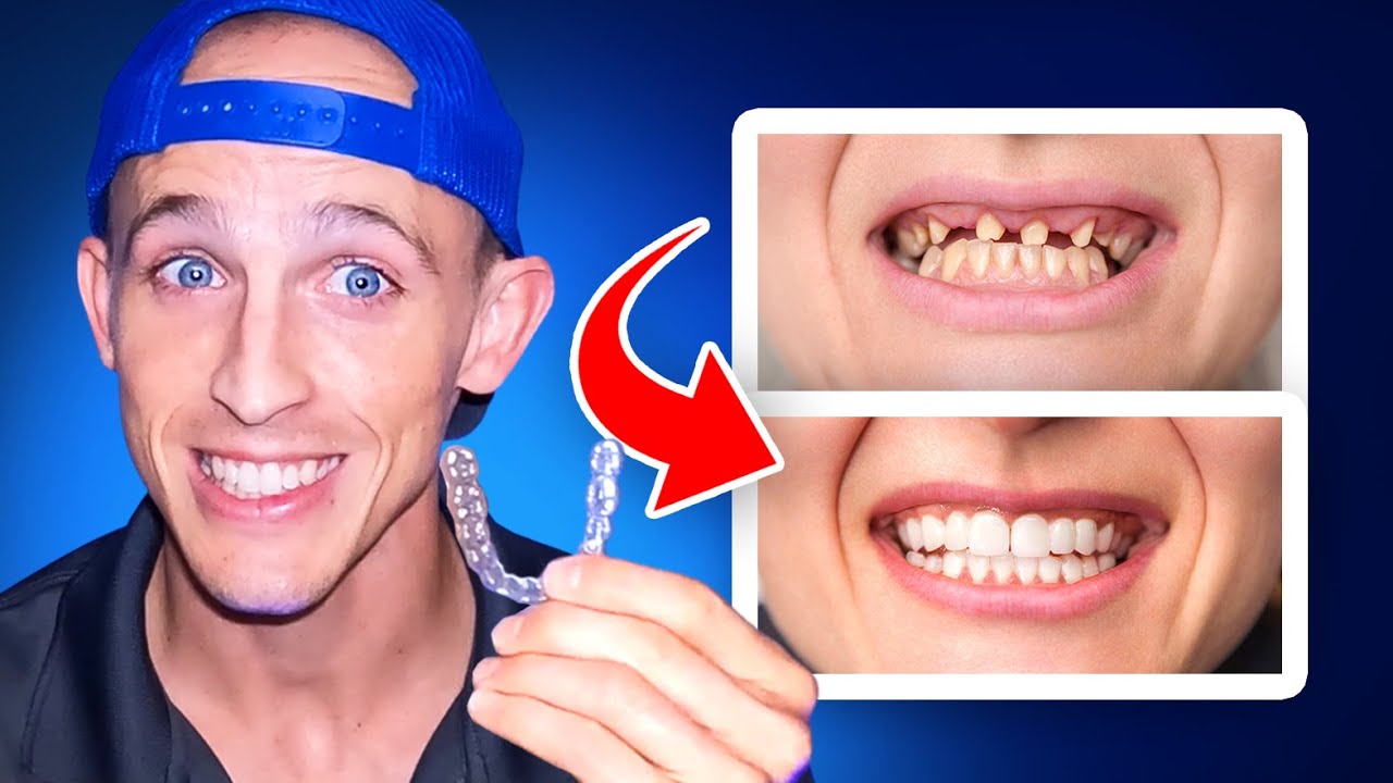 How Orthodontists deal with MISSING teeth... Getting Braces and Invisalign...