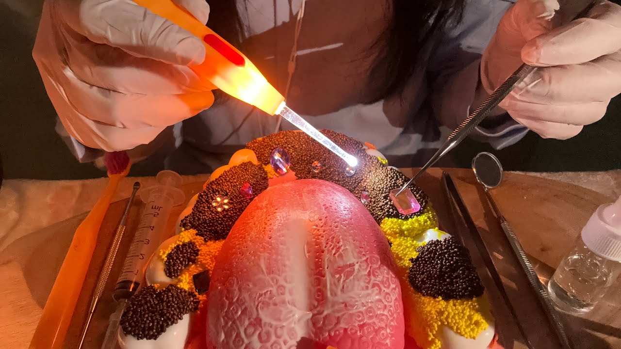 치과 ASMR🦷 극한의 치석 제거 팅글 롤플레이 Dental Cleaning