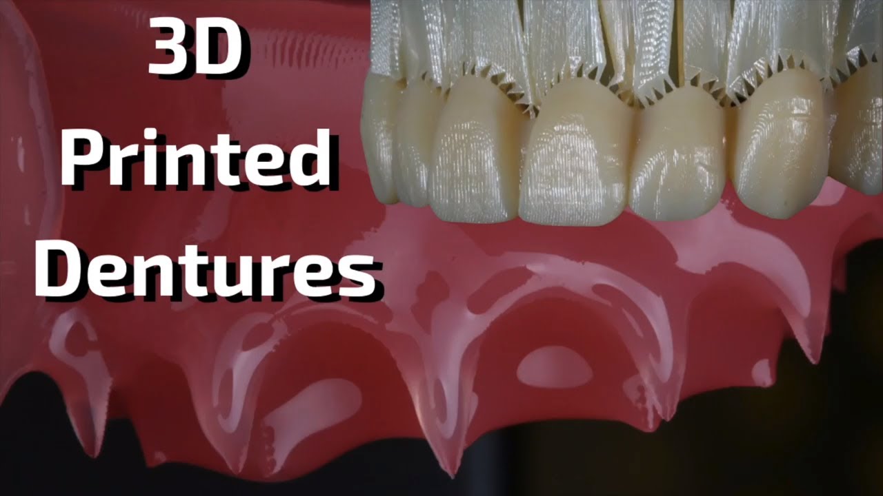 3D Printed Dentures - What, Why, How?
