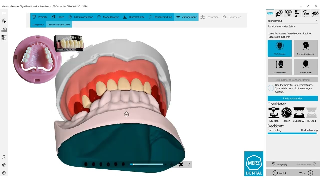 BDCreator PLUS: BDLoadXP, Set-up individuell, File Split (de) | #BalticDentureSystem #DigitalDenture