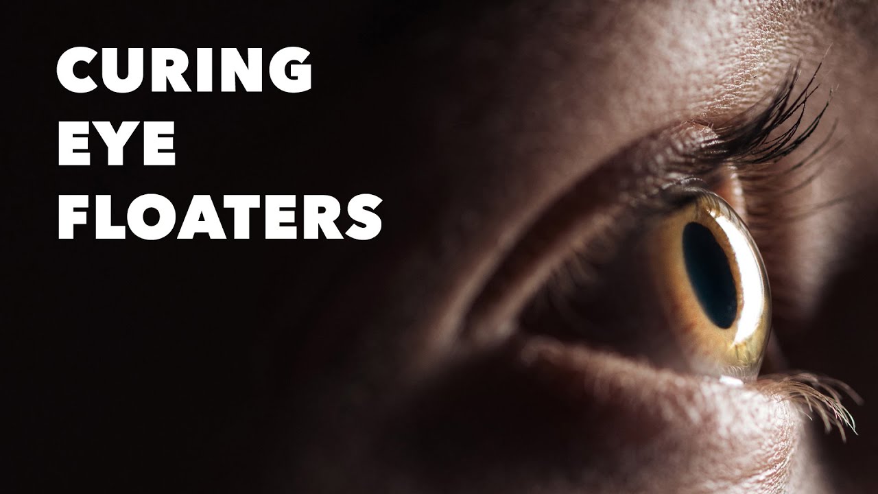 This Startup's Bold Mission to Use Lasers to Fix Eye Floaters