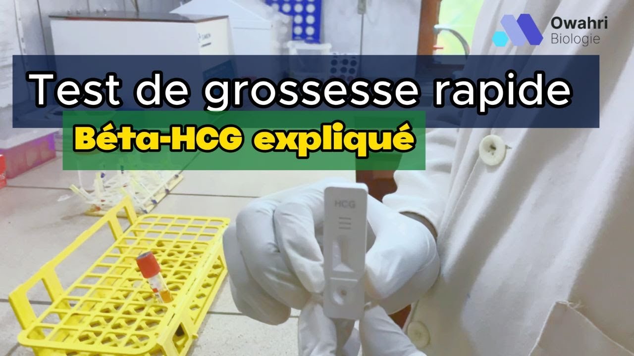 Comment Réaliser un Test de Grossesse Rapide Immunochromatographique du Béta-HCG  : Guide Pratique