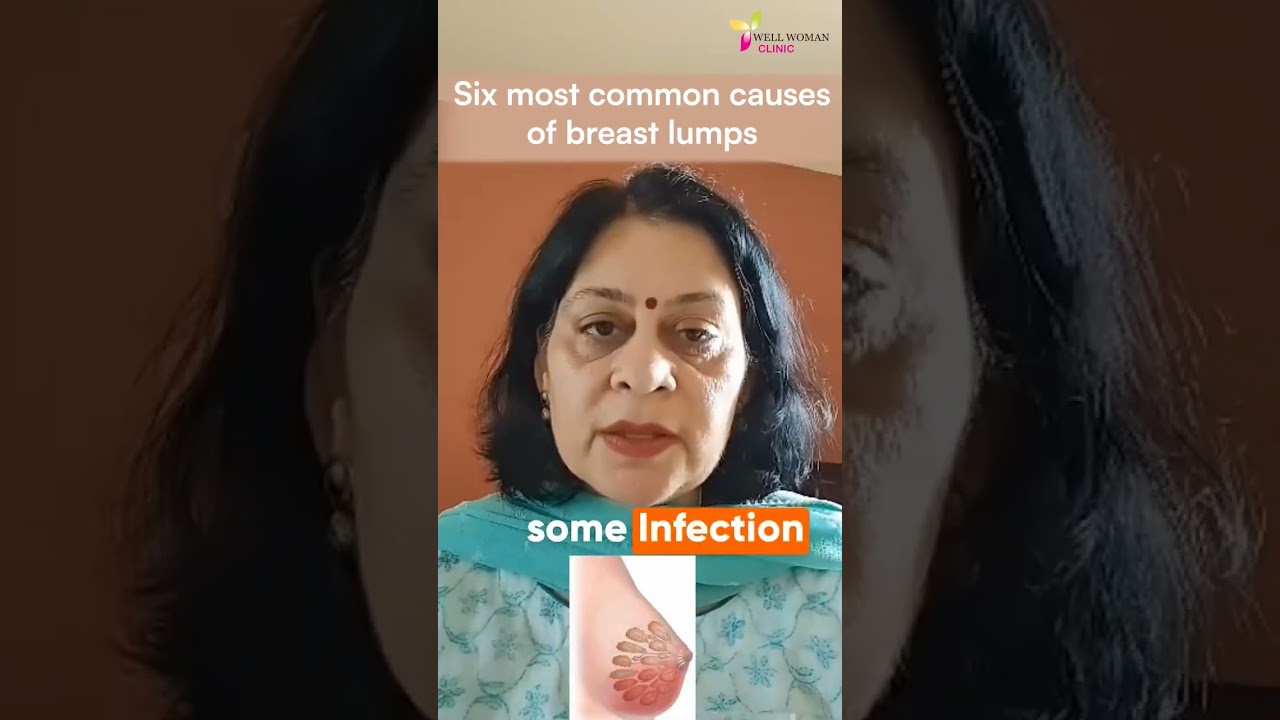 𝐒𝐢𝐱 𝐦𝐨𝐬𝐭 𝐜𝐨𝐦𝐦𝐨𝐧 𝐜𝐚𝐮𝐬𝐞𝐬 𝐨𝐟 𝐛𝐫𝐞𝐚𝐬𝐭 𝐥𝐮𝐦𝐩𝐬 | 𝐃𝐫 𝐍𝐮𝐩𝐮𝐫 𝐆𝐮𝐩𝐭𝐚 | 𝐖𝐞𝐥𝐥 𝐖𝐨𝐦𝐚𝐧 𝐂𝐥𝐢𝐧𝐢𝐜