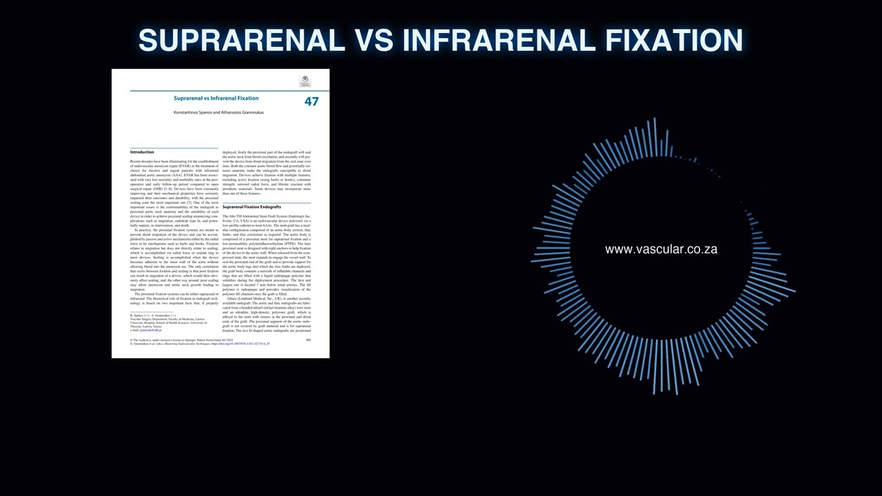 MET - 47 - Suprarenal vs Infrarenal Fixation - Deep Dive Podcast