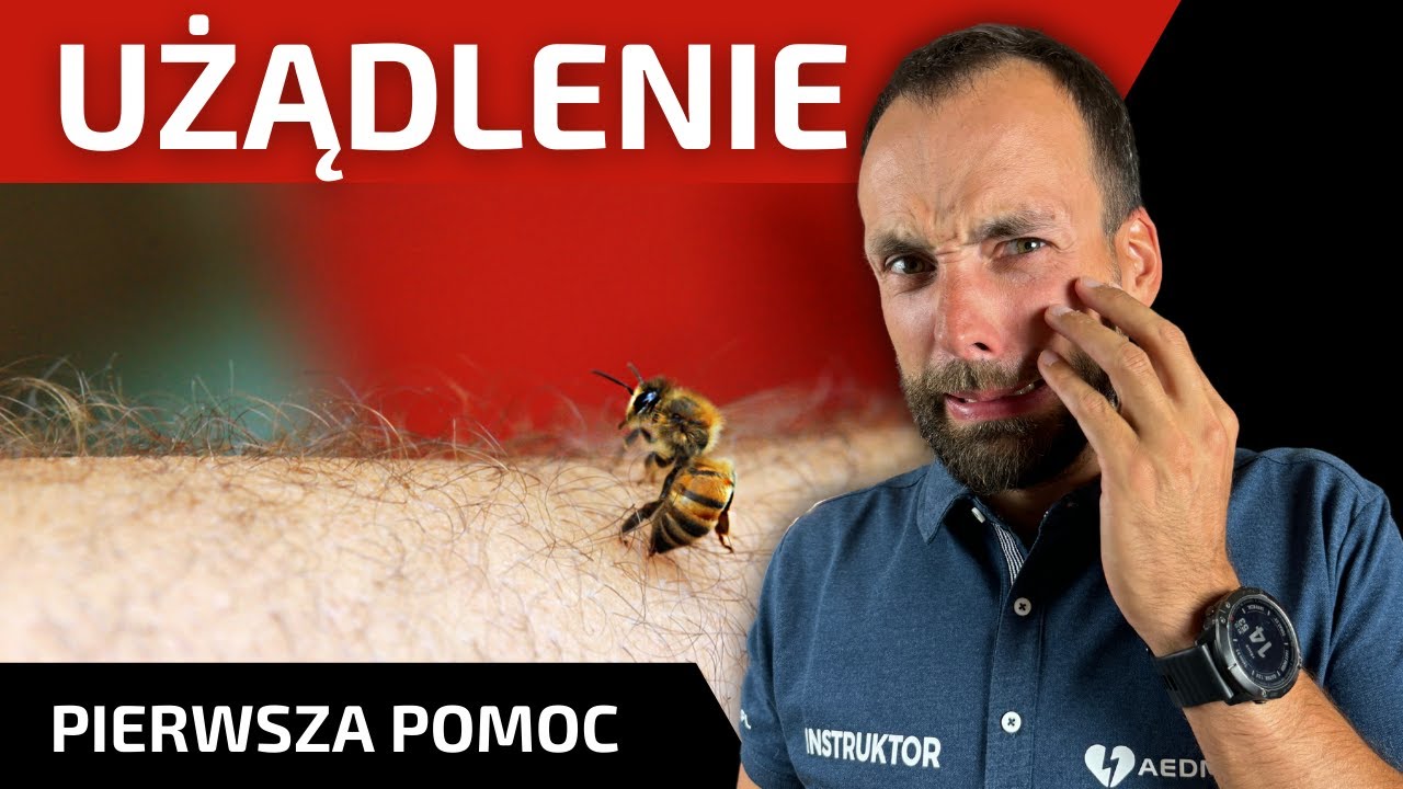 Co zrobić w przypadku użądlenia przez owady? Pierwsza Pomoc i Praktyczne Porady | AEDMAX.PL
