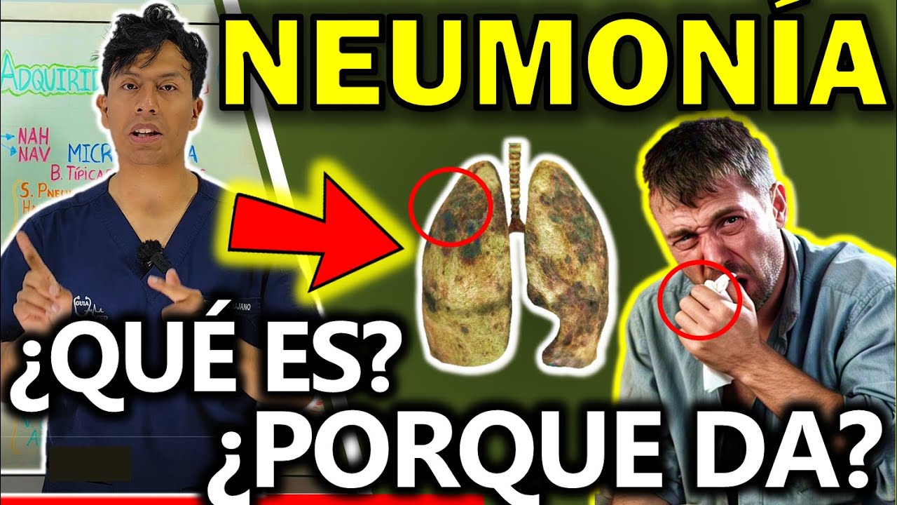 QUÉ ES NEUMONÍA Y PORQUÉ SE PRODUCE | GuiaMed