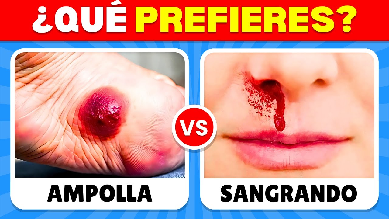 ¿Qué Prefieres? Edición EXTREMA 🤔✅❓ ¡60 Decisiones Más Difíciles!
