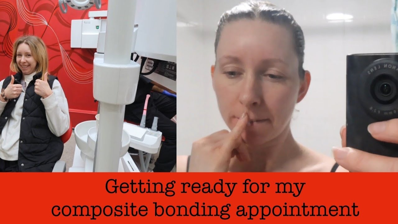 Part 1: Getting ready for my composite bonding initial appointment!