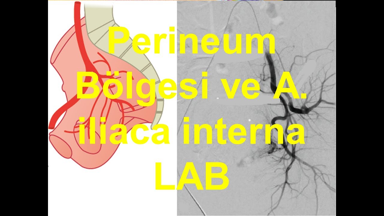 Perineum Bölgesi ve A  iliaca interna LAB