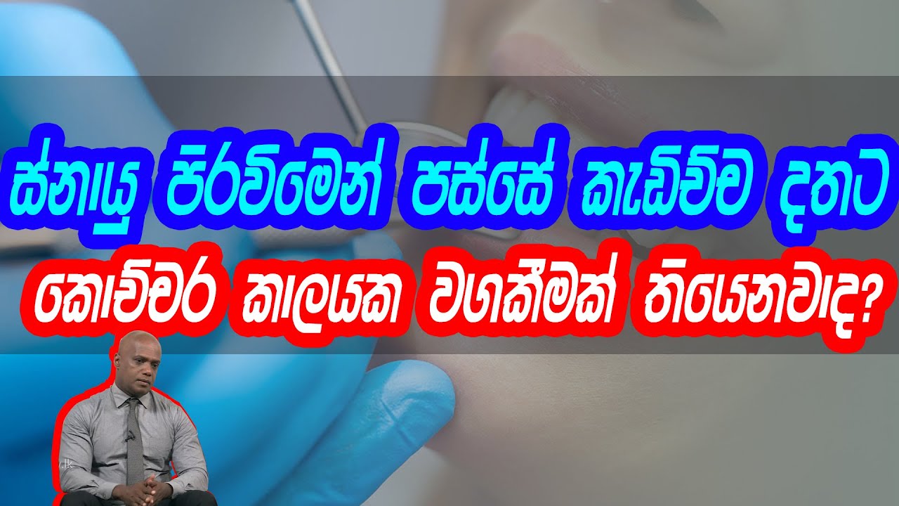ස්නායු පිරවිමෙන් පස්සේ කැඩිච්ච දතට කොච්චර කාලයක වගකීමක් තියෙනවාද?| Piyum Vila |14-08-2020|Siyatha TV