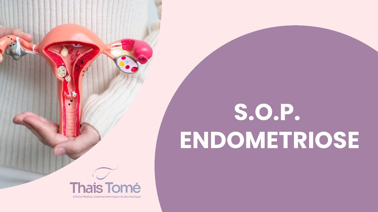 #Live SOP e Endometriose 