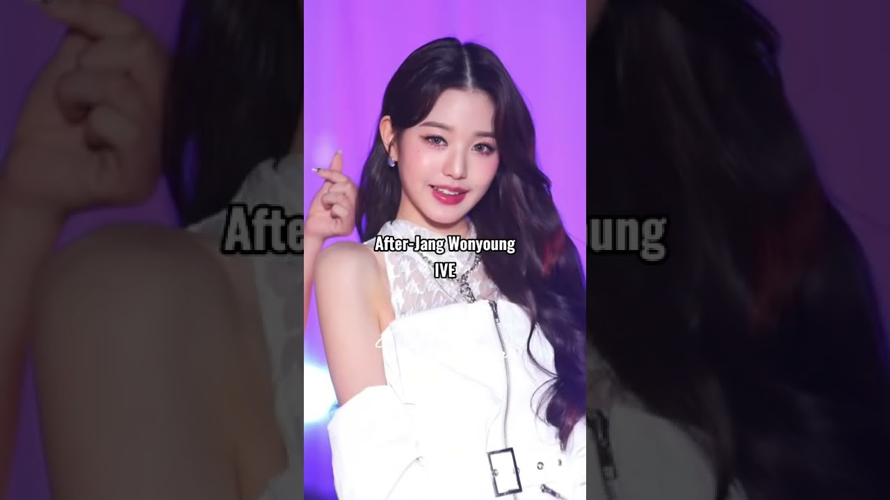 Idols before surgery and after surgery 
