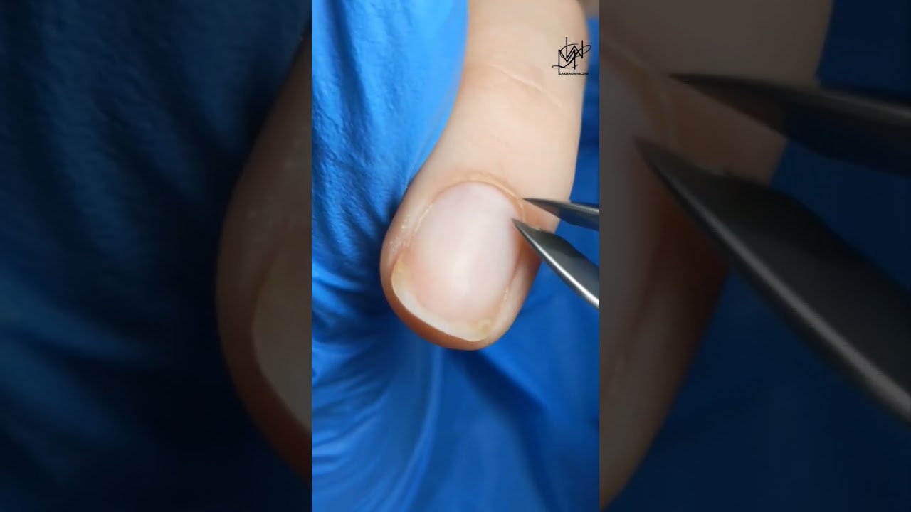 JAK PRACOWAĆ CĄŻKAMI? Zobaczcie jak wycinać sk&oacute;rki modelem Staleks Expert 90-5mm #paznokcie #nails