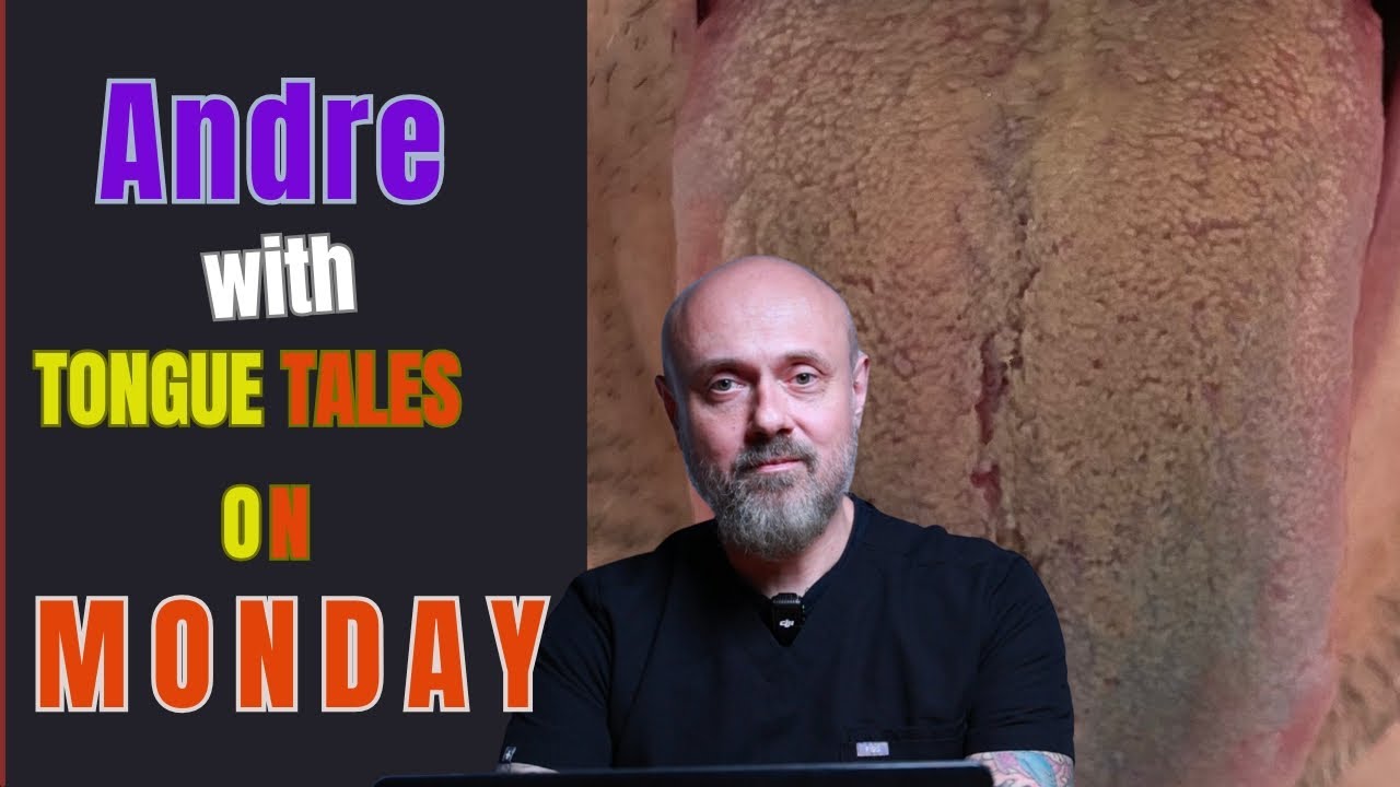 TONGUE TALES ON MONDAY: Hypertension, Insomnia, Cholesterol