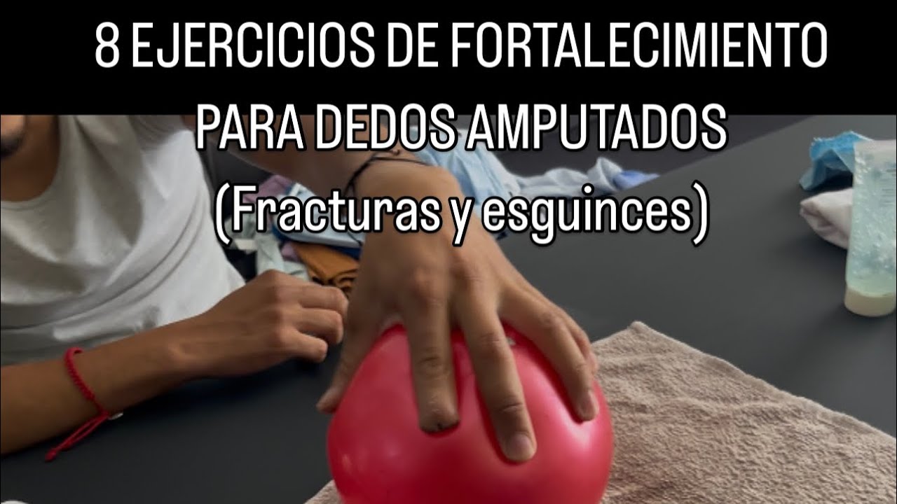 8 Ejercicios de fortalecimiento para dedos amputados, esguinces de dedos o fracturas
