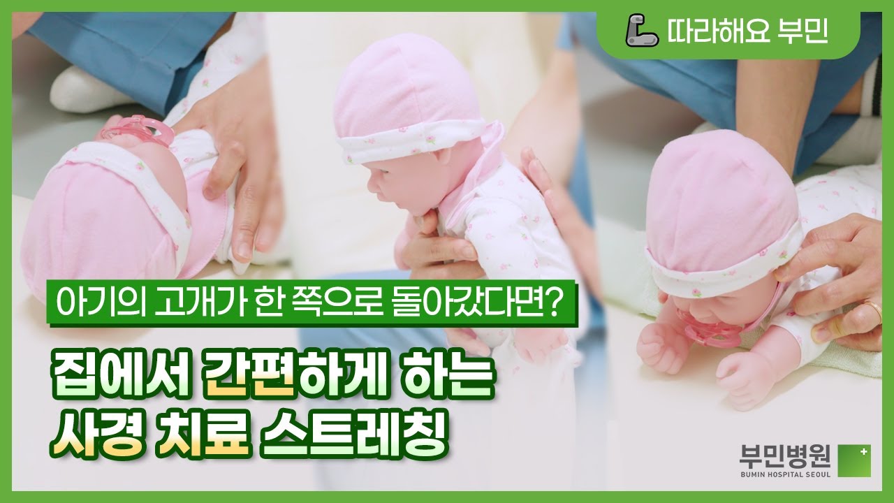한쪽으로 돌아간 아기 고개, 집에서 사경 치료해주세요! (신생아 사경 재활 스트레칭 방법 소개)