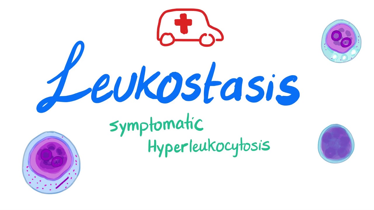 Leukostasis (Symptomatic Hyperleukocytosis)