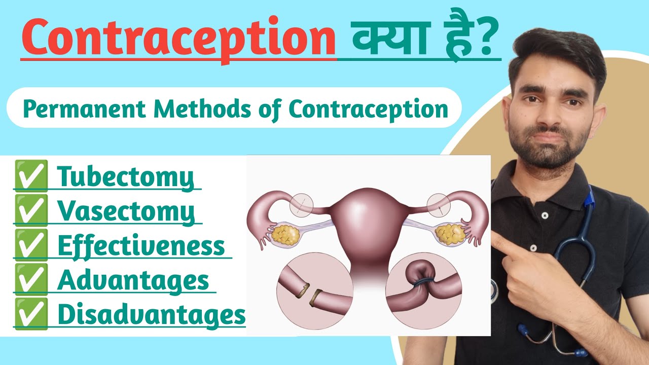 Permanent Methods of Contraception in Hindi | Tubectomy And Vasectomy in Hindi